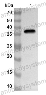 Anti-Human CD84 Polyclonal Antibody