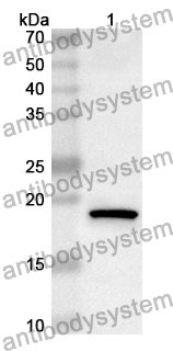 Anti-TMEFF2 Polyclonal Antibody