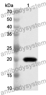 Anti-Human AKAP11 Polyclonal Antibody