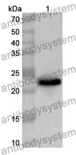 Anti-Human ADAMTS7 Polyclonal Antibody