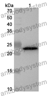 Anti-Human ADAM28 Polyclonal Antibody