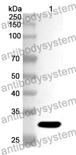 Anti-ANGPTL2 Polyclonal Antibody