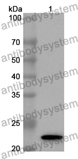 Anti-MCTS1 Polyclonal Antibody