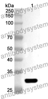 Anti-MTUS1 Polyclonal Antibody