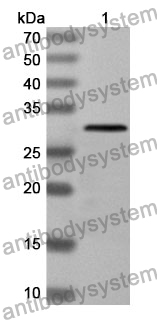 Anti-RNF112 Polyclonal Antibody