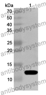 Anti-ASC/TMS1/PYCARD Polyclonal Antibody