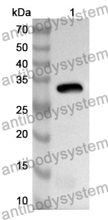 Anti-CD246/ALK Polyclonal Antibody