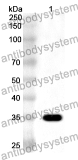 Anti-COL17A1 Polyclonal Antibody