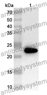 Anti-Human COL17A1 Polyclonal Antibody