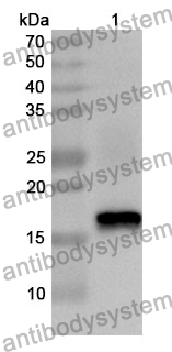 Anti-ADAMTS5 Polyclonal Antibody