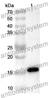 Anti-PLA2G2D Polyclonal Antibody