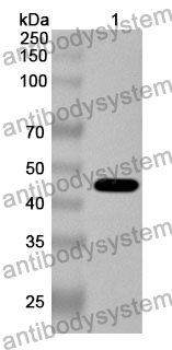 Anti-PSMD13 Polyclonal Antibody