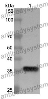 Anti-BAIAP2 Polyclonal Antibody