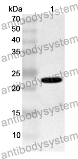 Anti-SMC3 Polyclonal Antibody