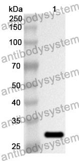 Anti-Human SH2B3 Polyclonal Antibody