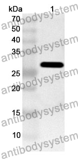 Anti-NOD1 Polyclonal Antibody