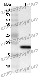 Anti-POMP Polyclonal Antibody