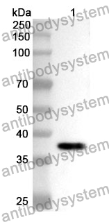 Anti-INVS Polyclonal Antibody