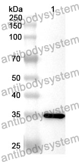 Anti-TP53TG5 Polyclonal Antibody