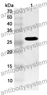 Anti-GSTK1 Polyclonal Antibody