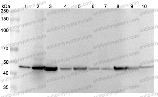 Anti-GDA Polyclonal Antibody