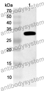 Anti-KCNIP3 Polyclonal Antibody