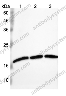 Anti-RNF11 Polyclonal Antibody