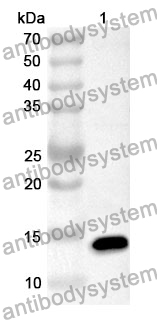 Anti-CBY1 Polyclonal Antibody