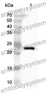 Anti-GRIP1 Polyclonal Antibody