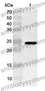 Anti-RAD54L2 Polyclonal Antibody