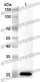 Anti-IRS2 Polyclonal Antibody