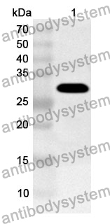 Anti-ANGPTL3 Polyclonal Antibody