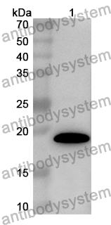 Anti-CD2AP Polyclonal Antibody