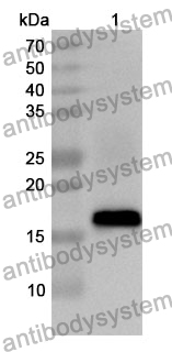 Anti-FADS3 Polyclonal Antibody