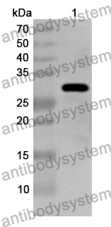 Anti-LIPG Polyclonal Antibody