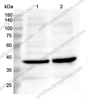 Anti-PSAT1 Polyclonal Antibody