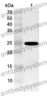 Anti-POMT1 Polyclonal Antibody