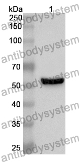 Anti-Human CYP46A1 Polyclonal Antibody