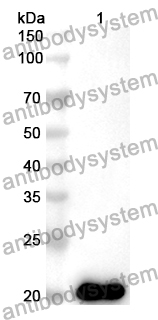 Anti-Human FCGBP Polyclonal Antibody