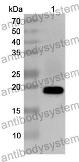 Anti-LY96 Polyclonal Antibody