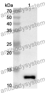 Anti-Human IgE/IGHE Polyclonal Antibody