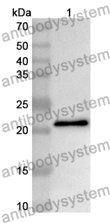 Anti-PLA2G12A Polyclonal Antibody