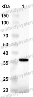 Anti-TWSG1 Polyclonal Antibody