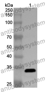 Anti-AP2M1 Polyclonal Antibody