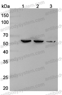 Anti-RTCB Polyclonal Antibody