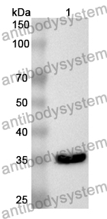 Anti-Human ACSF2 Polyclonal Antibody