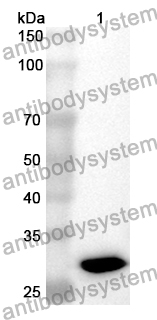 Anti-XPNPEP3 Polyclonal Antibody