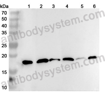 Anti-CFL2 Polyclonal Antibody