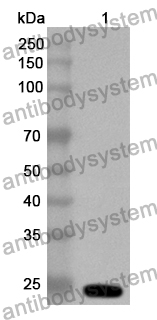 Anti-CALN1 Polyclonal Antibody