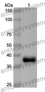 Anti-Human AATF Polyclonal Antibody